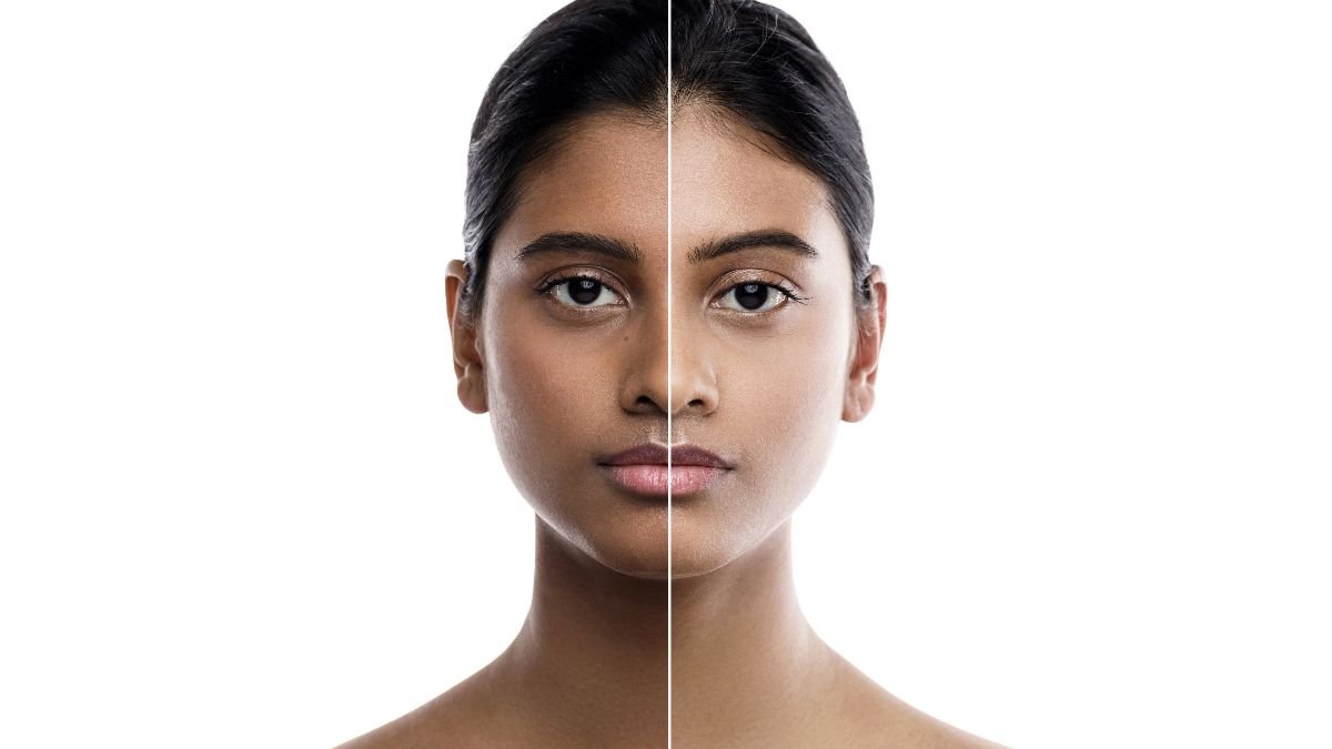 Pigmentation & Tan Care