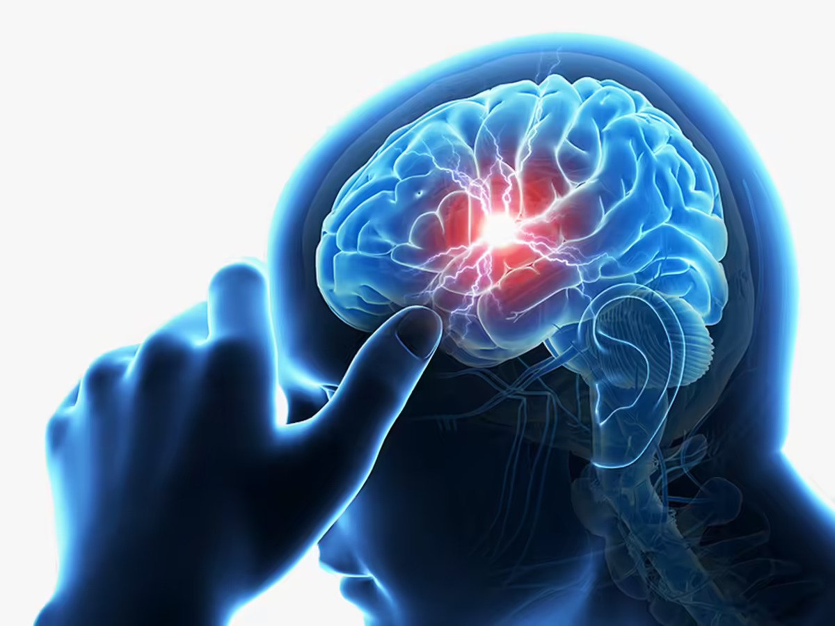 Neurology